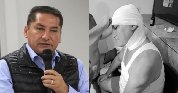 Portada: Ulises Villegas, alcalde de Comas, denuncia que sufrió atentado: delincuentes le rompieron la cabeza y robaron su auto
