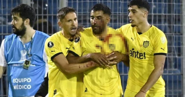 ¡Inaudito! Futbolista uruguayo es agredido con proyectil en la Copa Libertadores