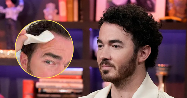 Kevin Jonas fue operado de urgencia por cáncer de piel