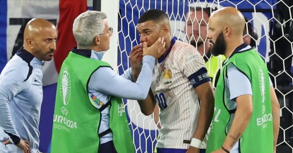 Kylian Mbappé no será operado tras sufrir fractura en la nariz, así lo informó la Federación Francesa