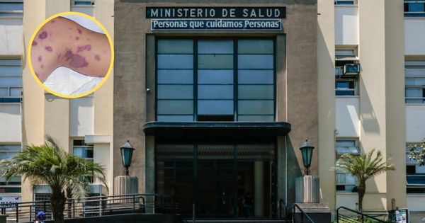 Loreto: Minsa anuncia acciones ante alarma de casos de meningitis meningocócica