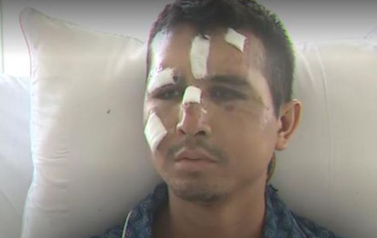 Policía herido en Andahuaylas: “fuimos atacados con piedras, hondas, jebes y material explosivo”