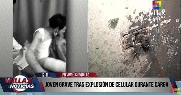 Surquillo: celular explota y deja a joven con severas quemaduras