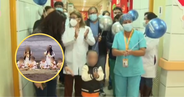 Lurín: niño que sufrió quemaduras en sesión fotográfica fue dado de alta