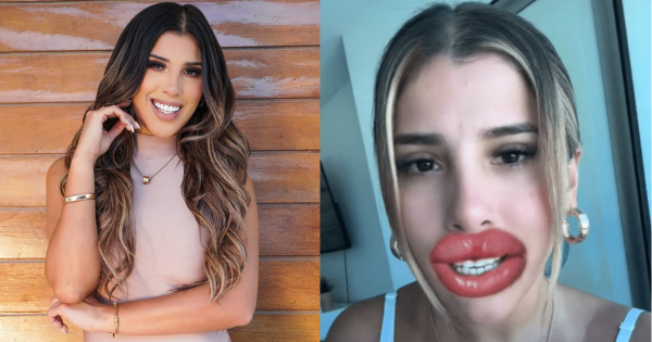 Yahaira Plasencia publica video sobre sus labios y usuarios reaccionan: "Ahora hazlo con el filtro"