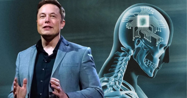 Portada: Neuralink, de Elon Musk, podrá implantar chips en cerebros humanos