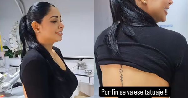 Pamela Franco se borra tatuaje de Christian Domínguez: "No va a dejar rastro de eso"