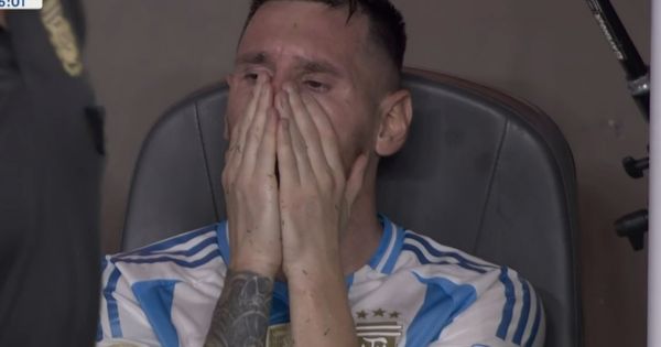 Portada: Lionel Messi: la impactante imagen del tobillo de la 'Pulga' tras salir lesionado de la final de la Copa América