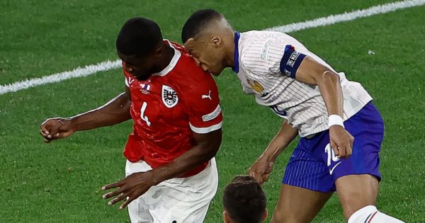 Kylian Mbappé se fracturó la nariz: Francia teme que ya no vuelva a jugar la Eurocopa 2024 porque será operado