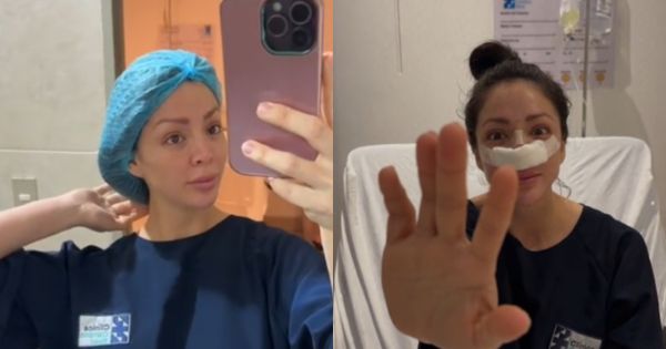 Sheyla Rojas se operó otra vez la nariz: "Adiós tabique desviado y roto"