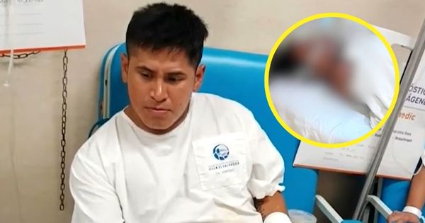 Villa El Salvador: hombre prendió fuego a su pareja y la dejó con el 90% del cuerpo quemado