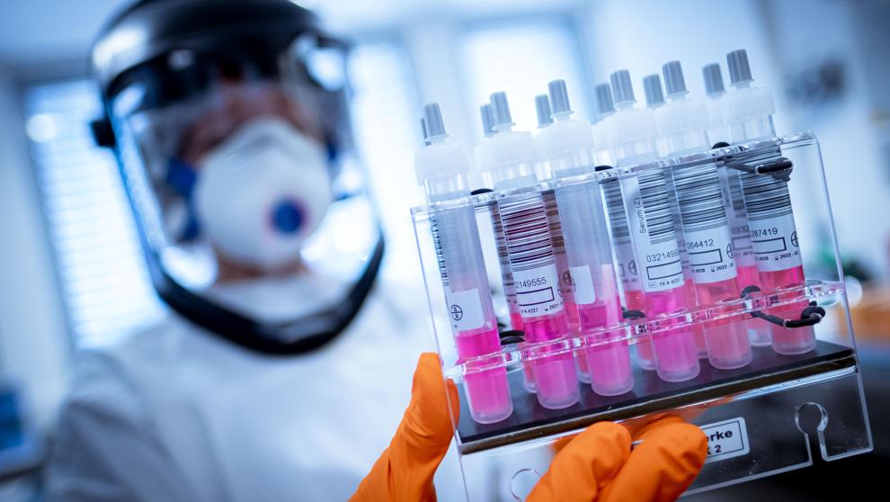 Portada: Alemania autoriza primeros ensayos clínicos de vacuna contra coronavirus.
