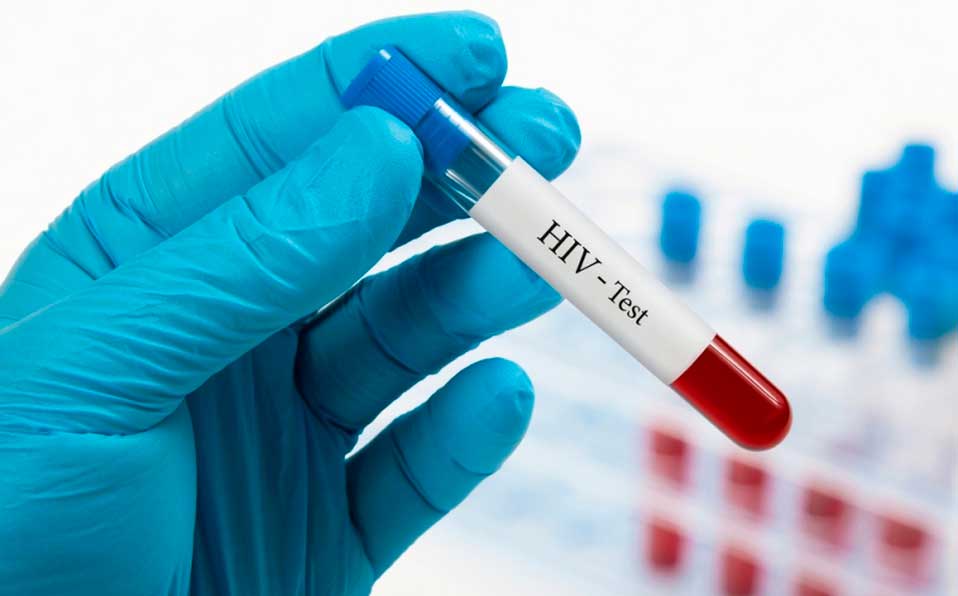 Más de 70 países corren el riesgo de quedarse sin medicamentos para el VIH por pandemia del coronavirus