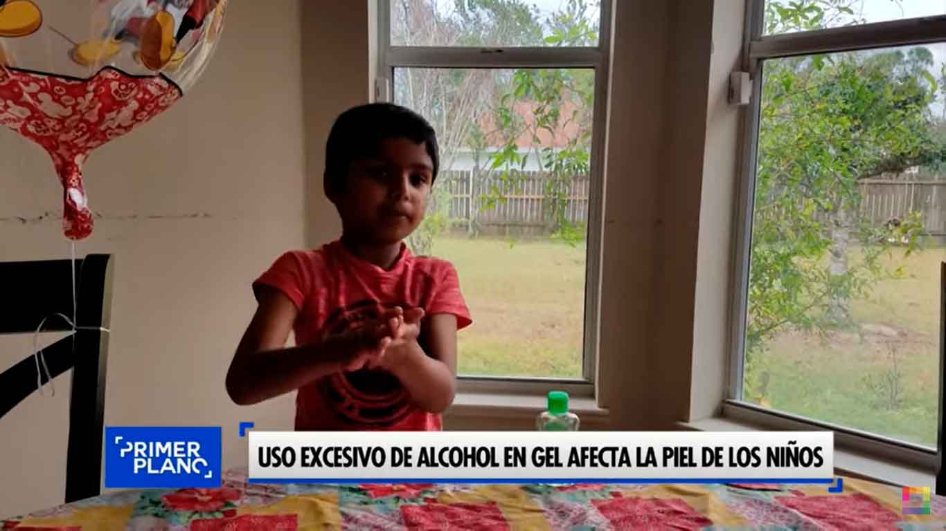 Uso excesivo de alcohol en gel afecta la piel de los niños