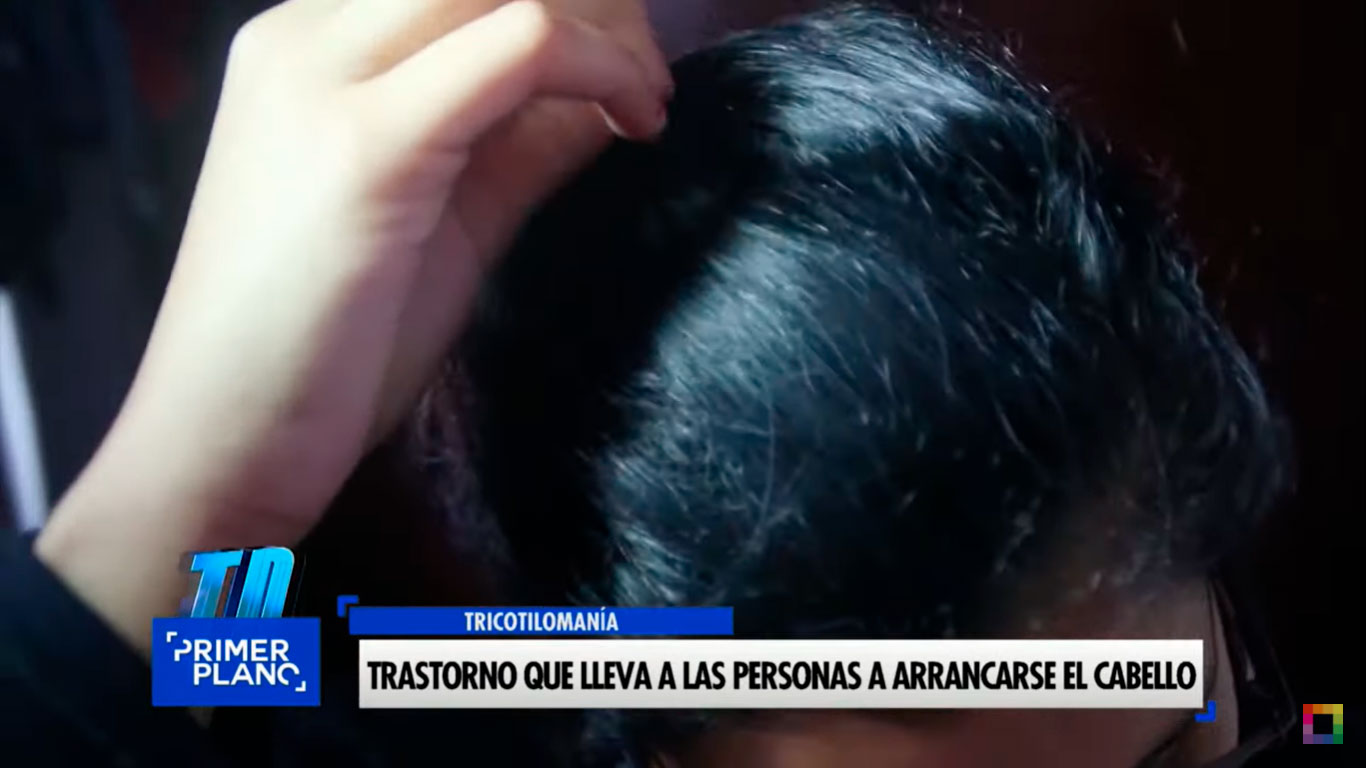 Portada: Conozca el trastorno que lleva a las personas a arrancarse el cabello