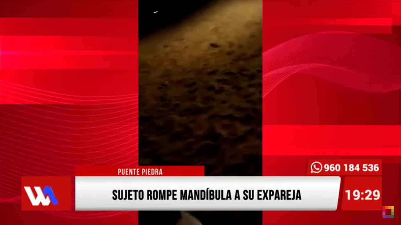 Sujeto rompe mandíbula a su expareja