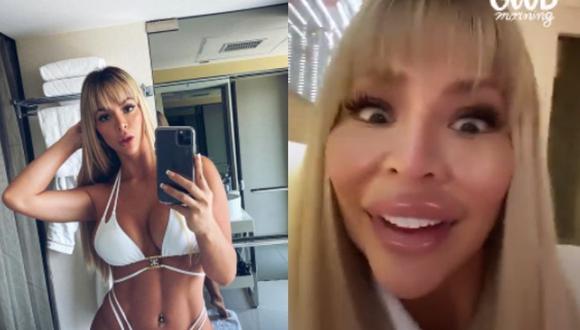 Amor y Fuego: Sheyla Rojas habla de sus cirugías estéticas