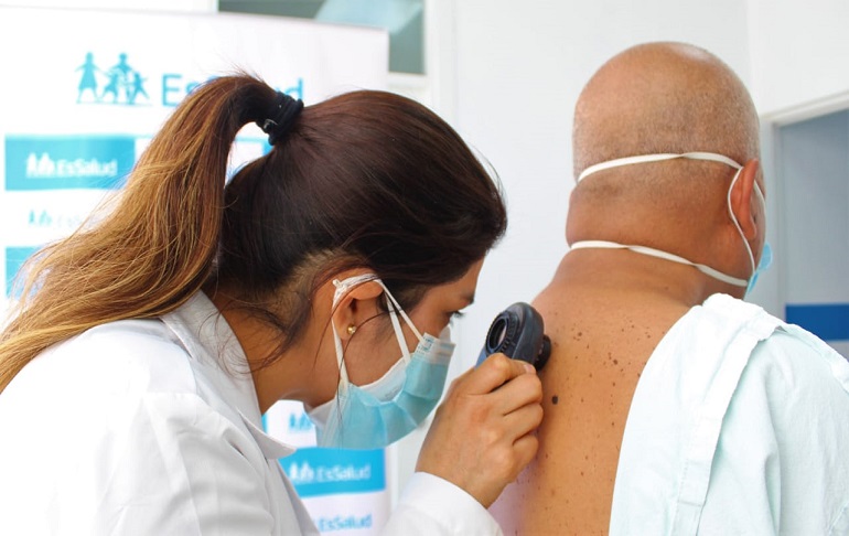 EsSalud trabaja en prevención de cáncer de piel ante reapertura de playas en temporada de invierno