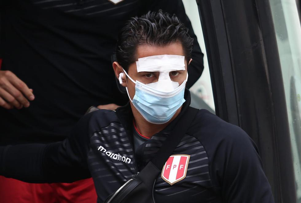 Gianluca Lapadula llegó con la nariz vendada al entrenamiento de la selección peruana