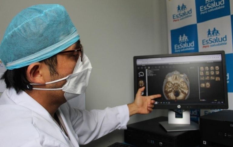 EsSalud: salvan la vida de paciente con malformación cerebral en hospital Sabogal