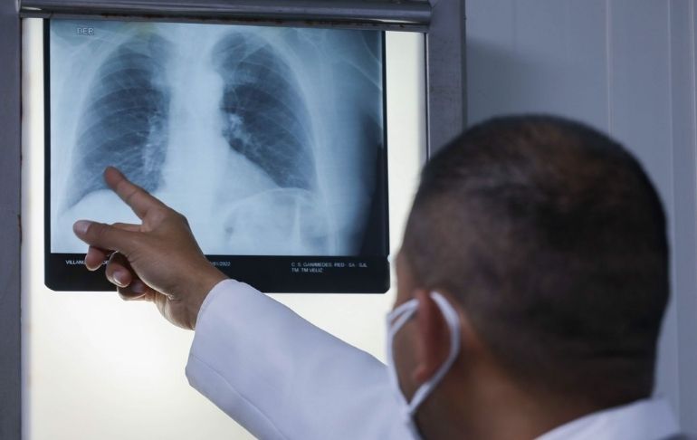 Portada: EsSalud alerta que tuberculosis peritoneal causa complicaciones que pueden llevar a la muerte