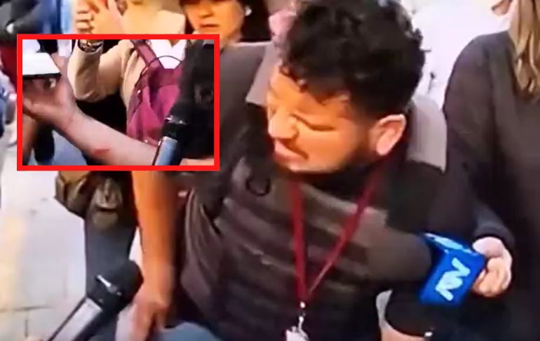 Periodista de PBO fue brutalmente atacado por violentos seguidores de Pedro Castillo [VIDEO]