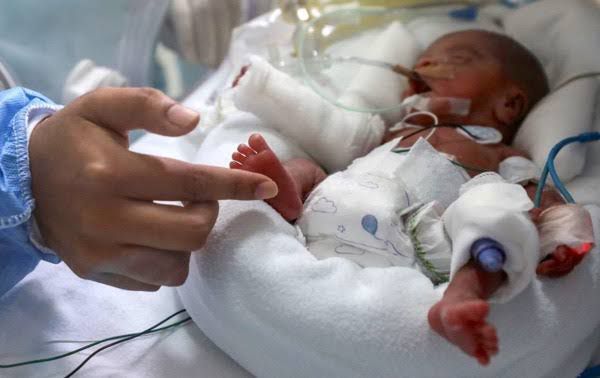 Congreso: presentan proyecto de ley de protección al nacido prematuro en el sistema nacional de salud