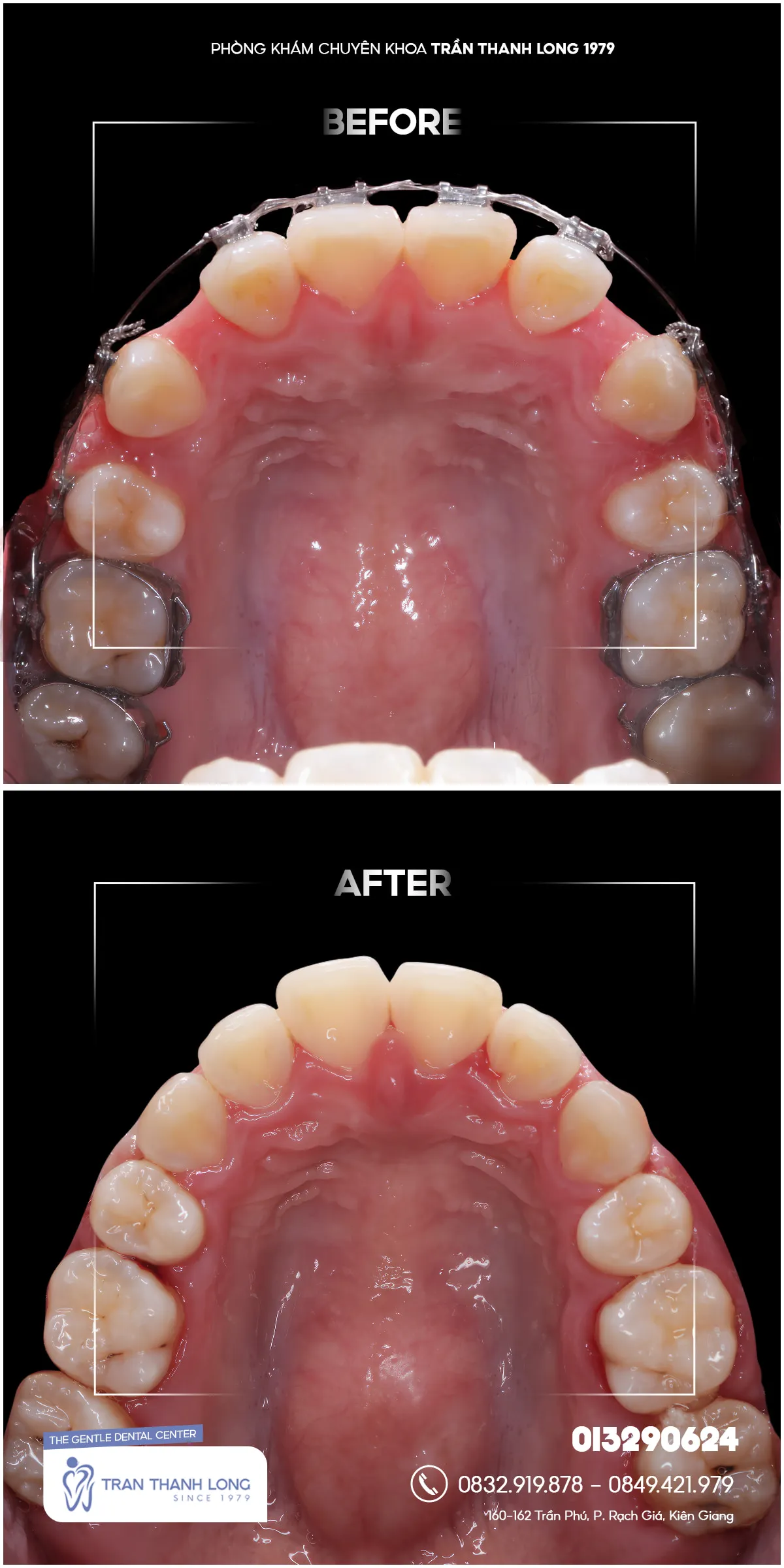 Hình ảnh quá trình điều trị 2