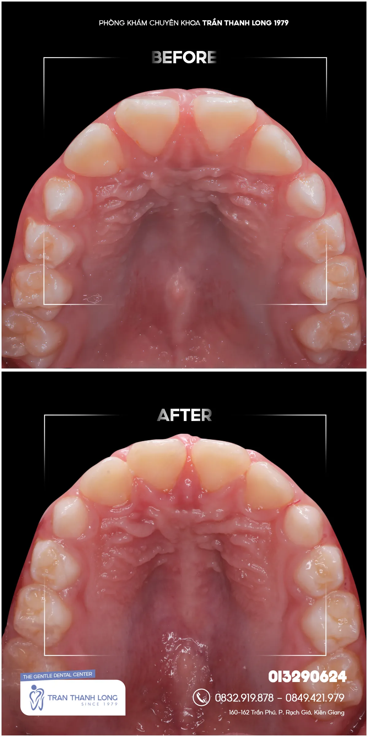 Hình ảnh quá trình điều trị 2