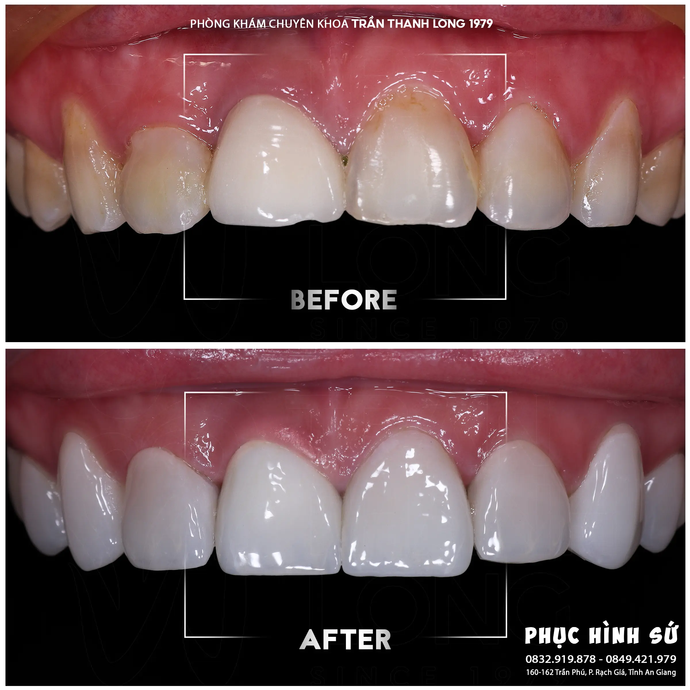 Hình ảnh quá trình điều trị 1