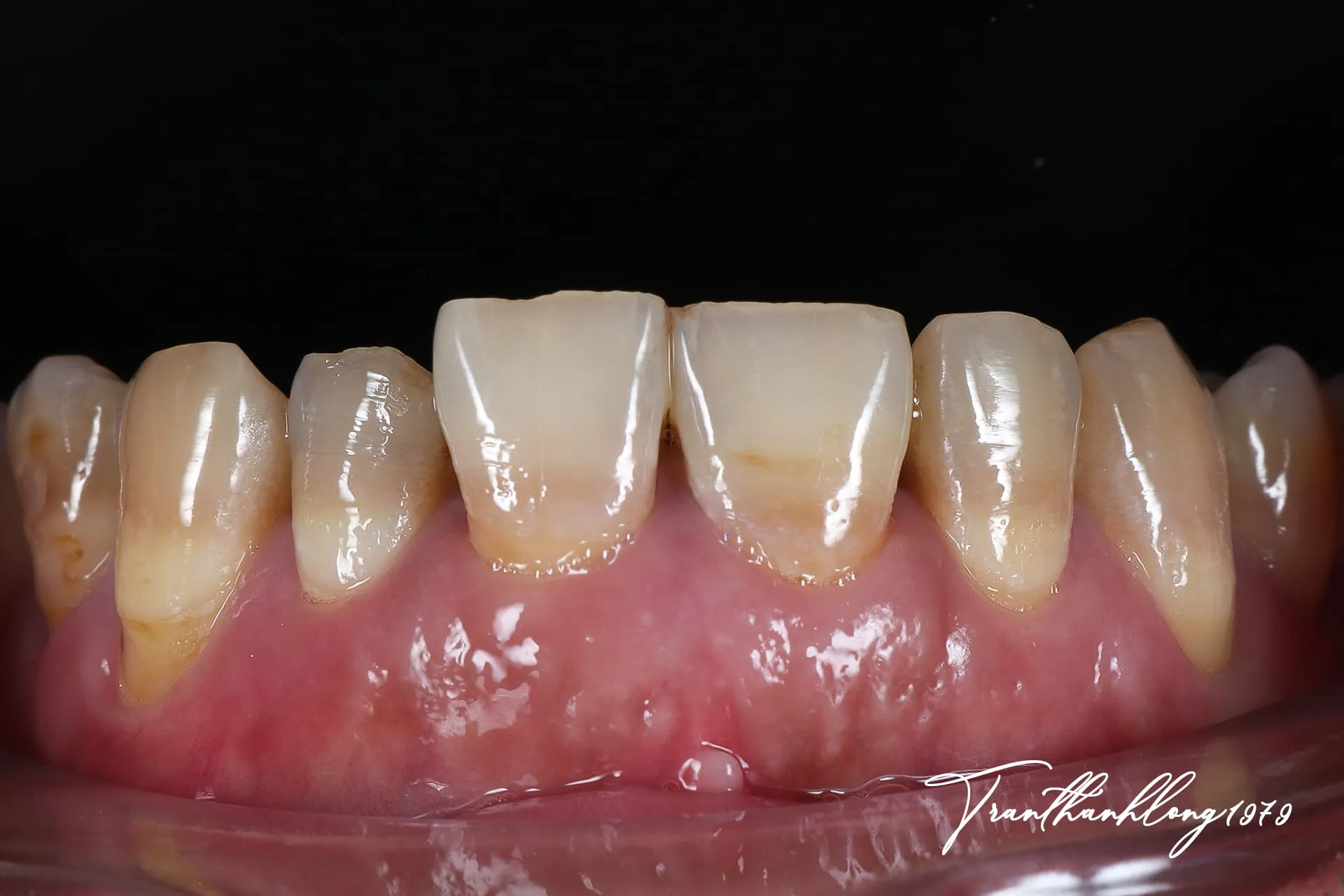 Before image