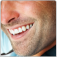Smile Makeover