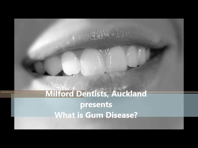 What Is Gum Disease