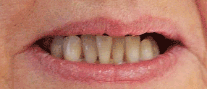 Milford Dentists Cosmetic Dentistry