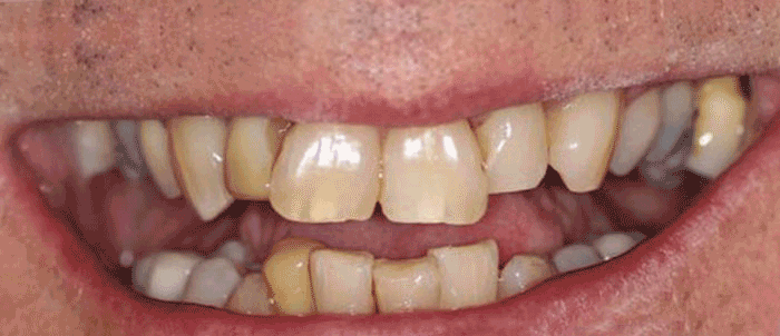 Milford Dentists Cosmetic Dentistry
