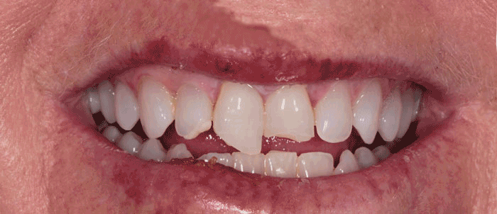 Emergency Dentistry