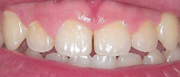 Milford Dentists Cosmetic Dentistry