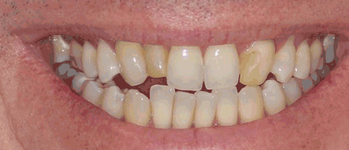 Milford Dentists Cosmetic Dentistry