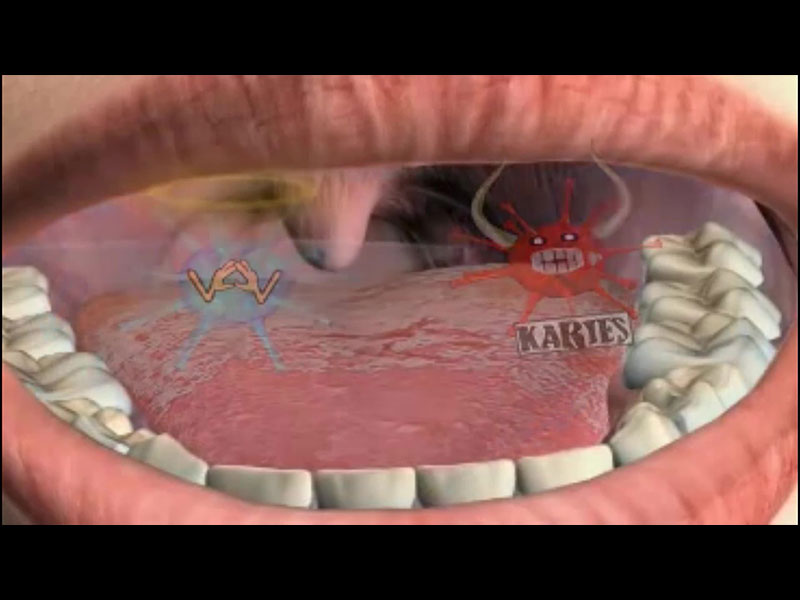 Keep Dental Decay At Bay