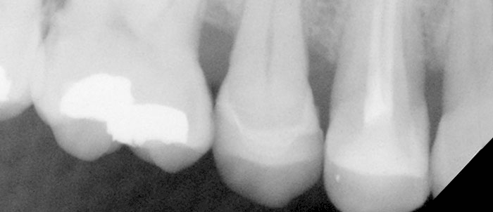 X Ray