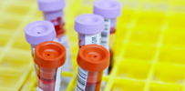 phlebotomy blood collection supplies