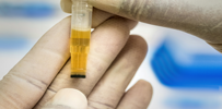 urine collection image