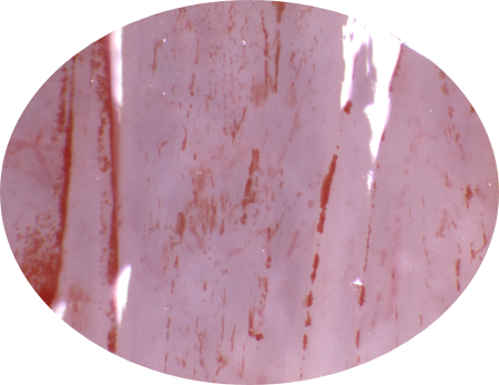 Image processing of the endometrial surface