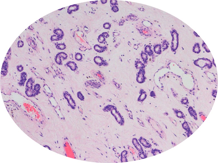 Endometrium imaged in vivo, later in the cycle