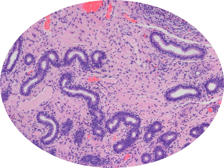 Endometrium imaged in vivo