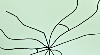TVGTeilvorgespanntes Glas