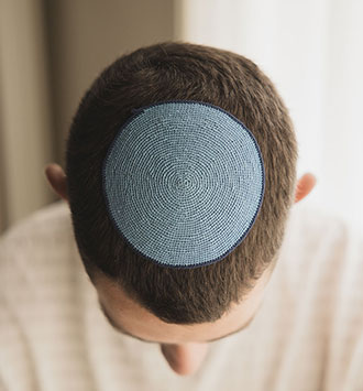 כיפה שטוחה