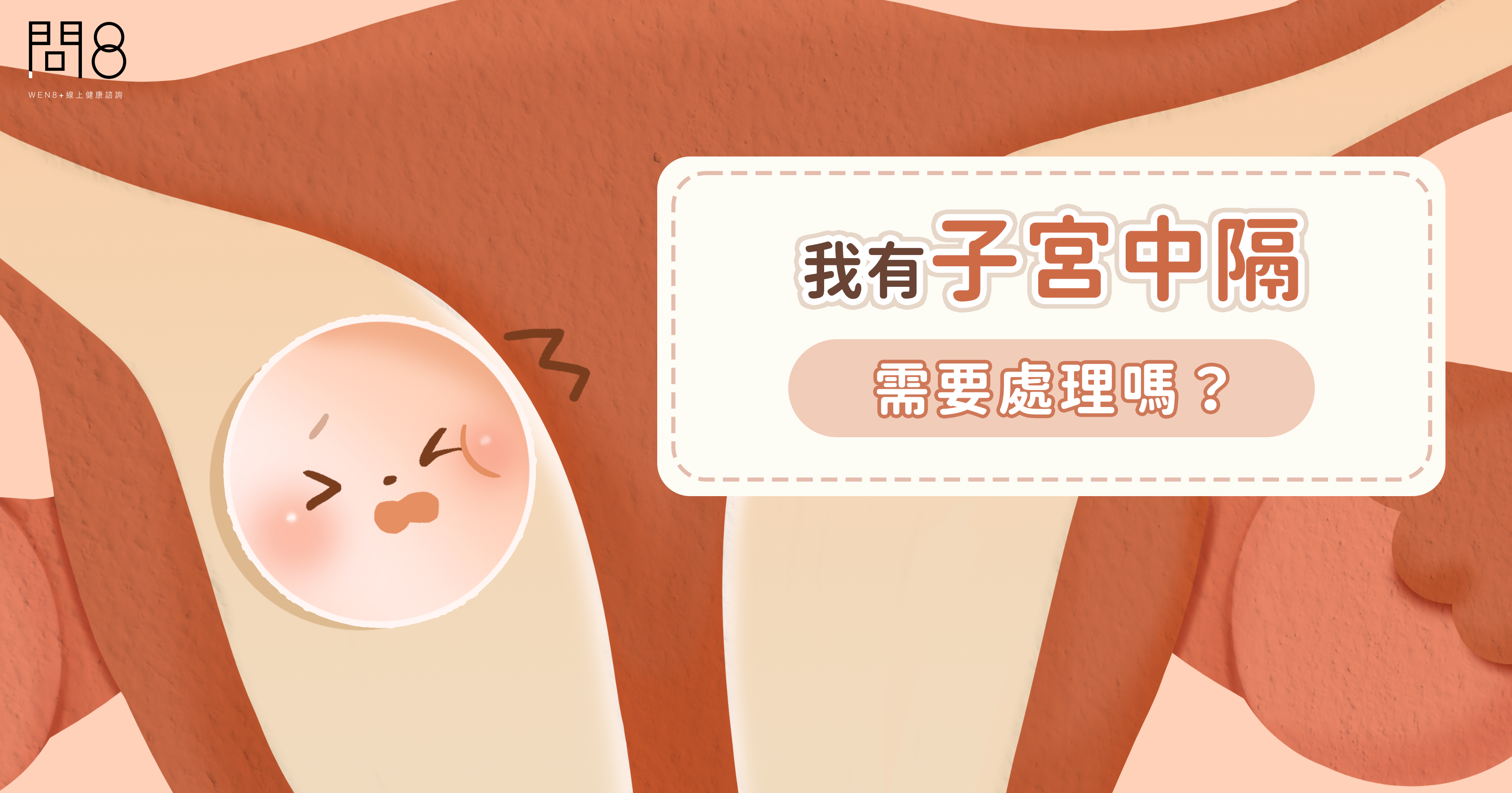 【蘇軒醫師】我有子宮中隔需要處理嗎?