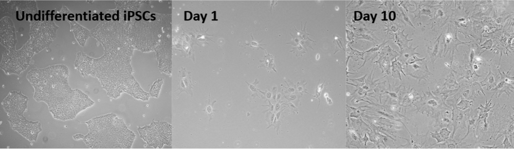 iPSC derived podocytes .png