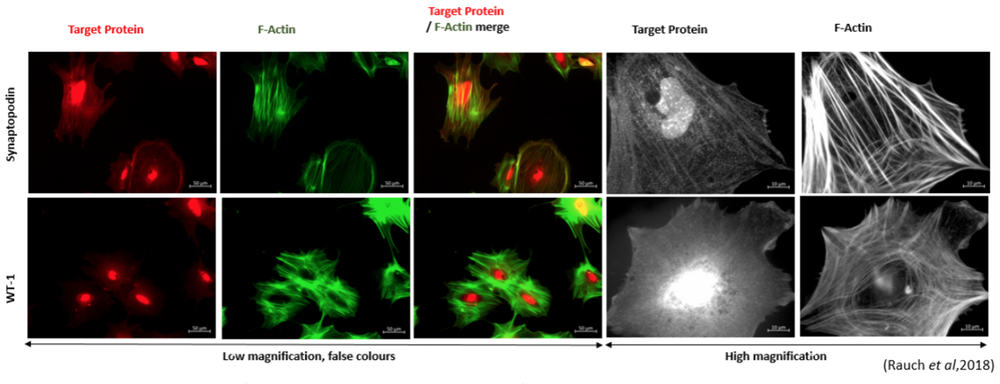 Podocyte Immunostaining